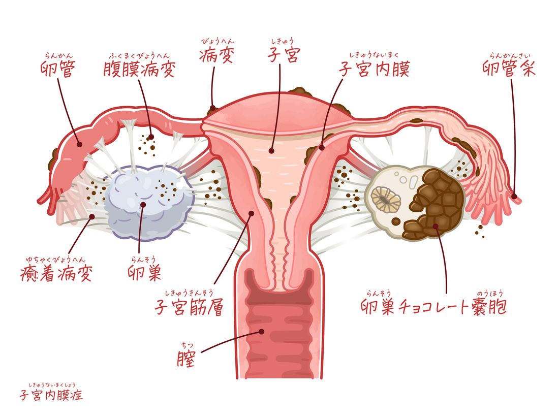 子宮・卵巣まわりの状態